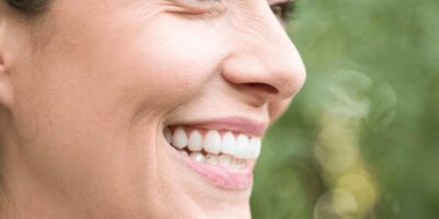 Η Σημασία των Retainers Μετά τη Θεραπεία Invisalign